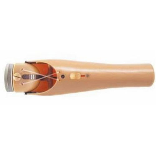 prosthetic component joint